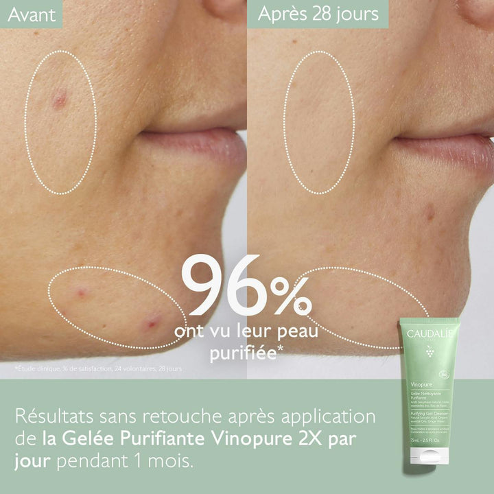 Caudalie Vinopure Gelée Nettoyante Purifiante 75 ml